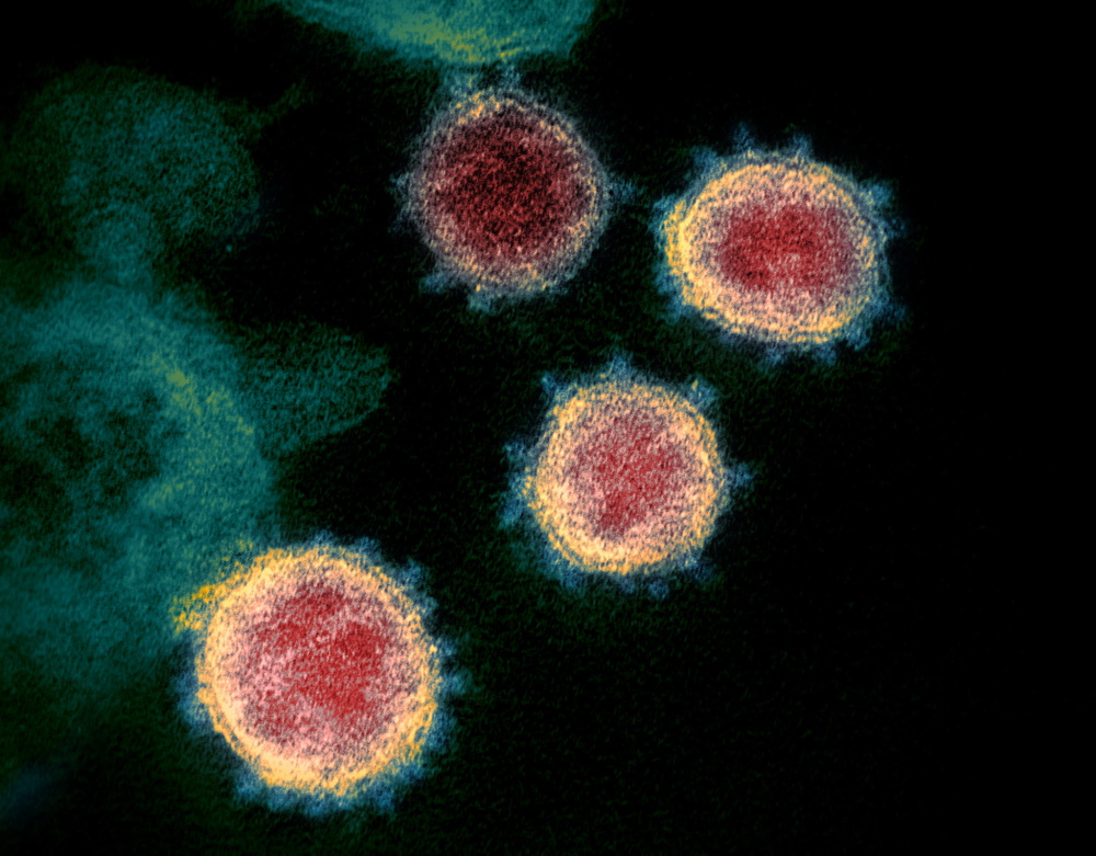 Obsługa pacjentów w trakcie trwania pandemii koronawirusa SARS-CoV-2